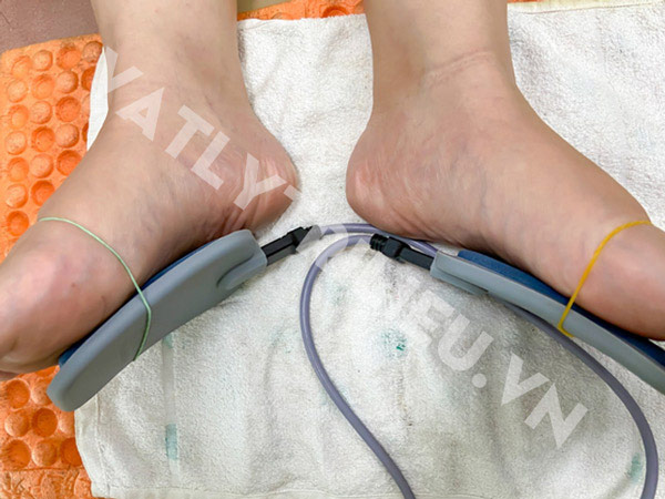 Đặt 2 bản cực đôi lên 2 lòng bàn chân của bệnh nhân